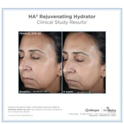 SkinMedica HA5 Rejuvenating Hydrator -Elizabeth Arde Shop 11290631 8544410181426350