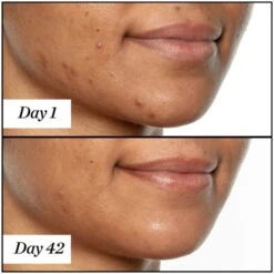 Sunday Riley U.F.O. Ultra-Clarifying Face Oil 35ml -Elizabeth Arde Shop 11588285 1494882144708740