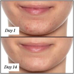 Sunday Riley U.F.O. Ultra-Clarifying Face Oil 35ml -Elizabeth Arde Shop 11588285 3034882144761189