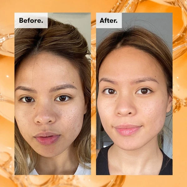 REN Clean Skincare Ready Steady Glow Daily AHA Tonic 250ml 9 REN Clean Skincare Ready Steady Glow Daily AHA Tonic 250ml - Image 7