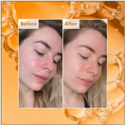 REN Clean Skincare Ready Steady Glow Daily AHA Tonic 250ml 11 REN Clean Skincare Ready Steady Glow Daily AHA Tonic 250ml -Elizabeth Arde Shop 11653879 5814894570495782