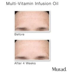 Murad Multi-Vitamin Infusion Oil -Elizabeth Arde Shop 11715656 6714571608023321