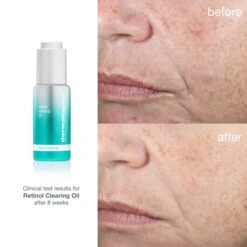 Dermalogica Retinol Clearing Acne Oil 1 Fl. Oz -Elizabeth Arde Shop 12651131 8264802553836832