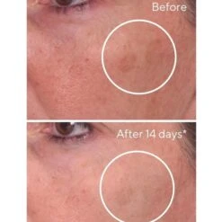 Murad Rapid Dark Spot Correcting Serum 30ml 15 Murad Rapid Dark Spot Correcting Serum 30ml -Elizabeth Arde Shop 12739129 1094898186604498