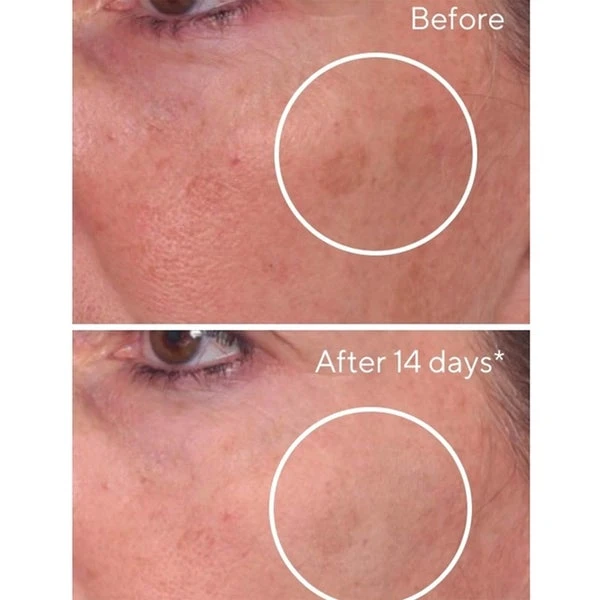 Murad Rapid Dark Spot Correcting Serum 30ml 6 Murad Rapid Dark Spot Correcting Serum 30ml - Image 4