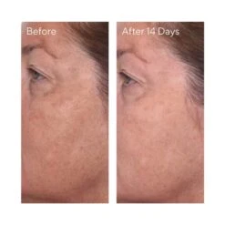 Murad Rapid Dark Spot Correcting Serum 30ml 17 Murad Rapid Dark Spot Correcting Serum 30ml -Elizabeth Arde Shop 12739129 1664830113317410