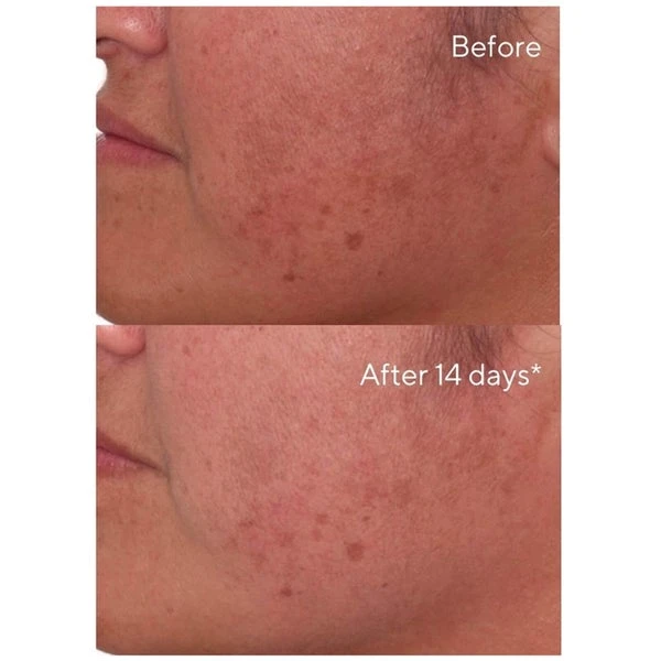 Murad Rapid Dark Spot Correcting Serum 30ml 4 Murad Rapid Dark Spot Correcting Serum 30ml - Image 2