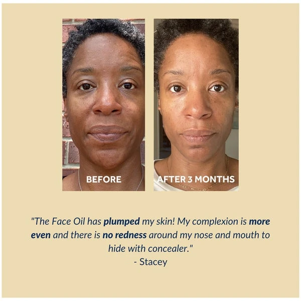 Gallinée Prebiotic Face Oil 30ml 8 Gallinée Prebiotic Face Oil 30ml - Image 6