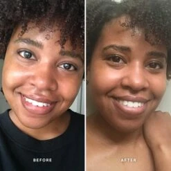 Alpha-H Vitamin C Serum With 10% Ethyl Ascorbic Acid 25ml -Elizabeth Arde Shop 13482802 5104931669936052