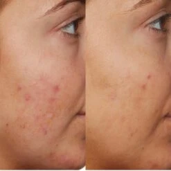 Sunday Riley Be Nice 10% Niacinamide Serum 30ml -Elizabeth Arde Shop 14653883 6095069298835458